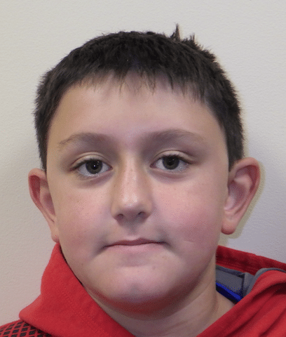 Orthodontics at PDOVA Richmond VA