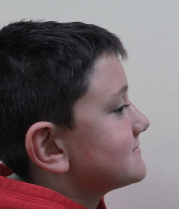 Orthodontics at PDOVA Richmond VA